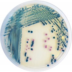 小肠炎耶尔森氏菌显色培养基