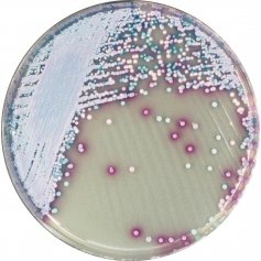 马拉色菌显色培养基