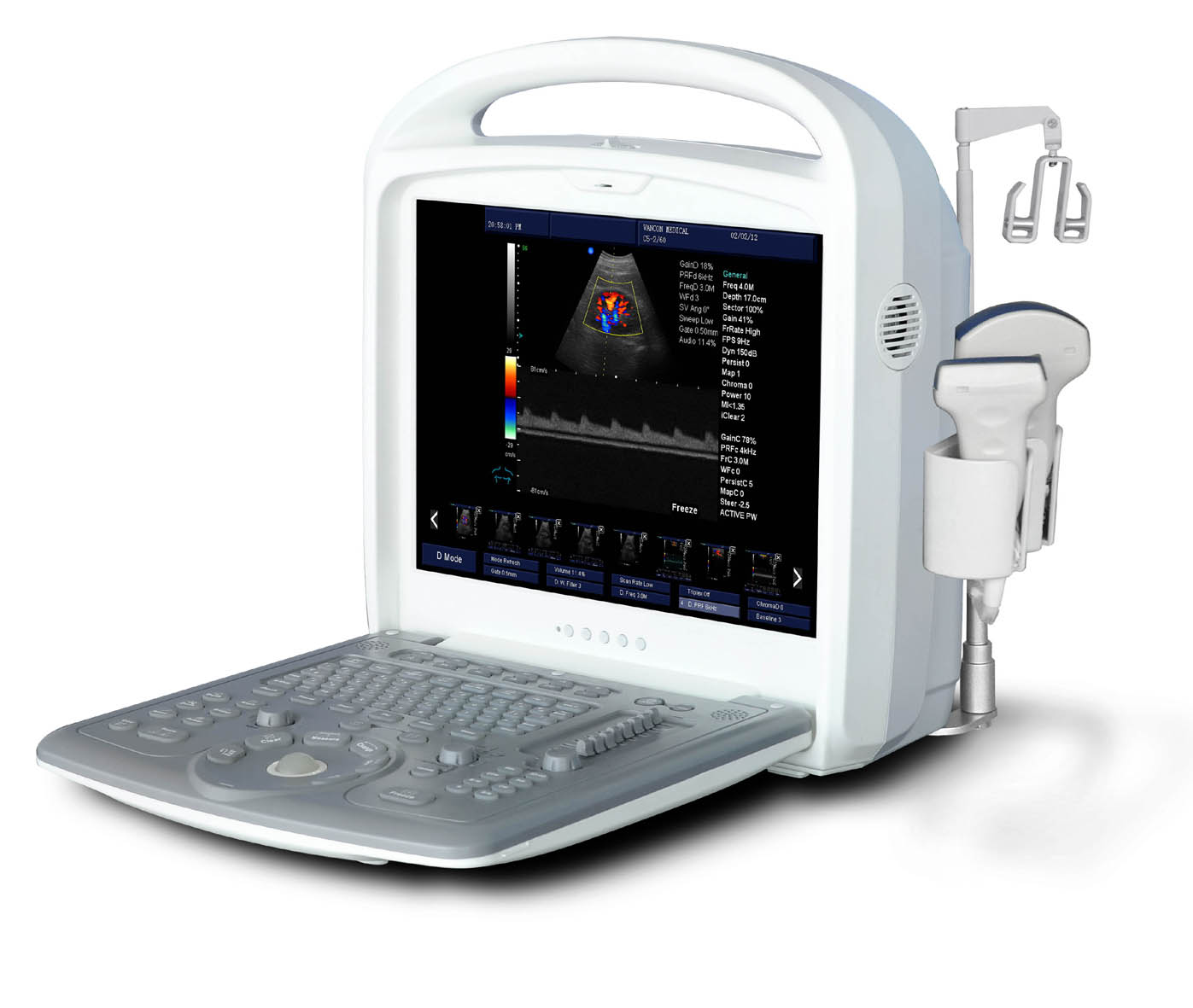供应全数字彩色多普勒超声诊断仪BLS-X3