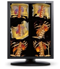 GE 核磁共振身体成像，儿科成像，心脏成像影像处理MOZO2M医用显示器