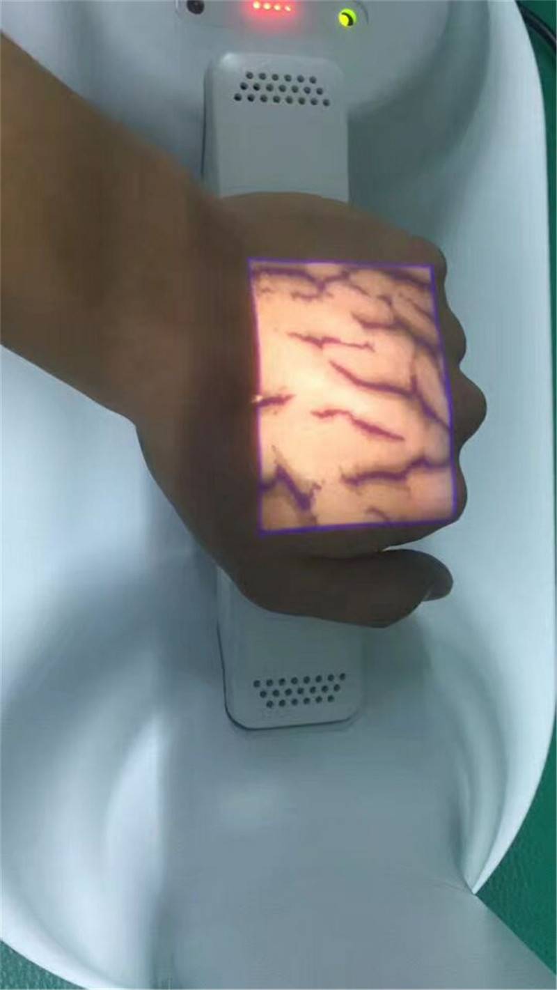 晋瑞静脉血管显像仪