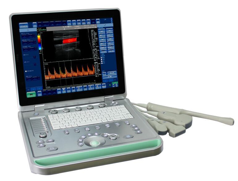 C2型彩色多普勒超声诊断系统便携式超声无线B超彩超
