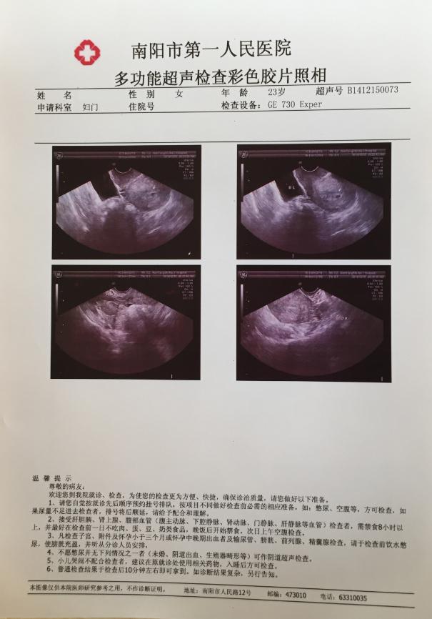 磨砂半透双面激光医用胶片