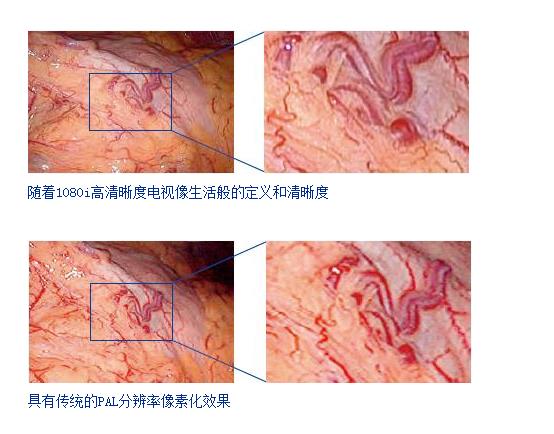 全国进口奥林巴斯腹腔镜生产商 使手术加