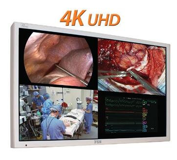 55寸4K UHD 医疗腹腔镜监视器FM-C5501DV 中国总代理