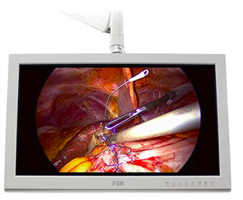 进口26寸医疗腹腔镜监视器FS-P2604D 优惠出售
