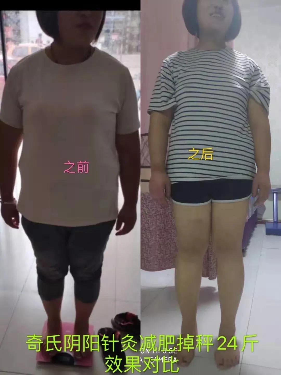 南宁张一圣玄针八卦疗法研修班价格