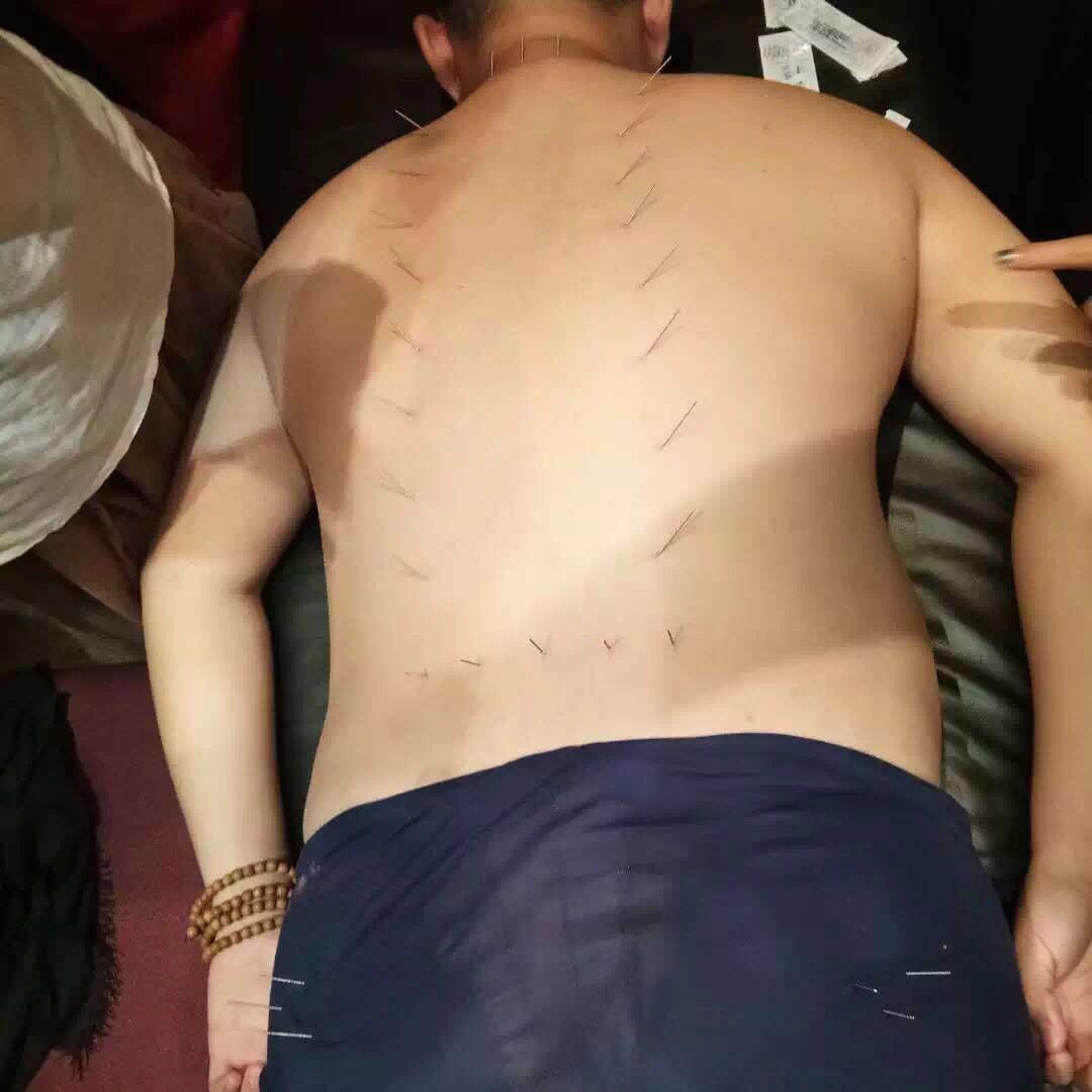 烟台专业老师吕晓峰针灸减肥培训报名电话