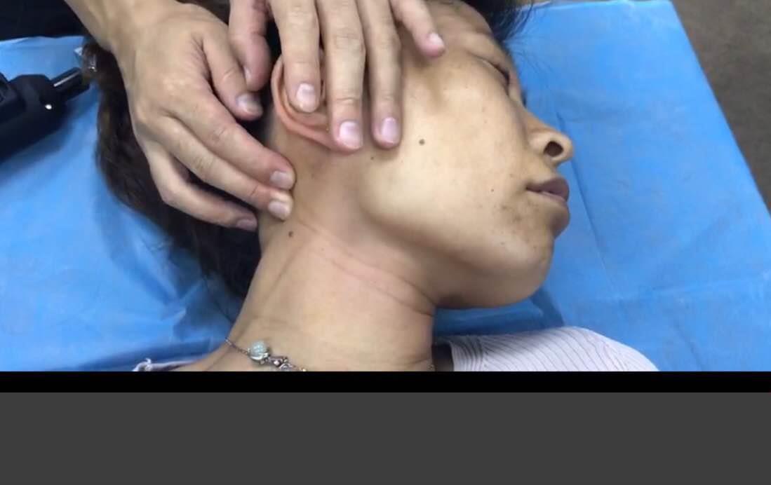 南宁产后骨盆修复培训