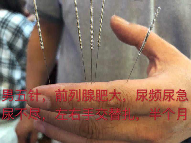 济南正宗董氏奇穴培训时间