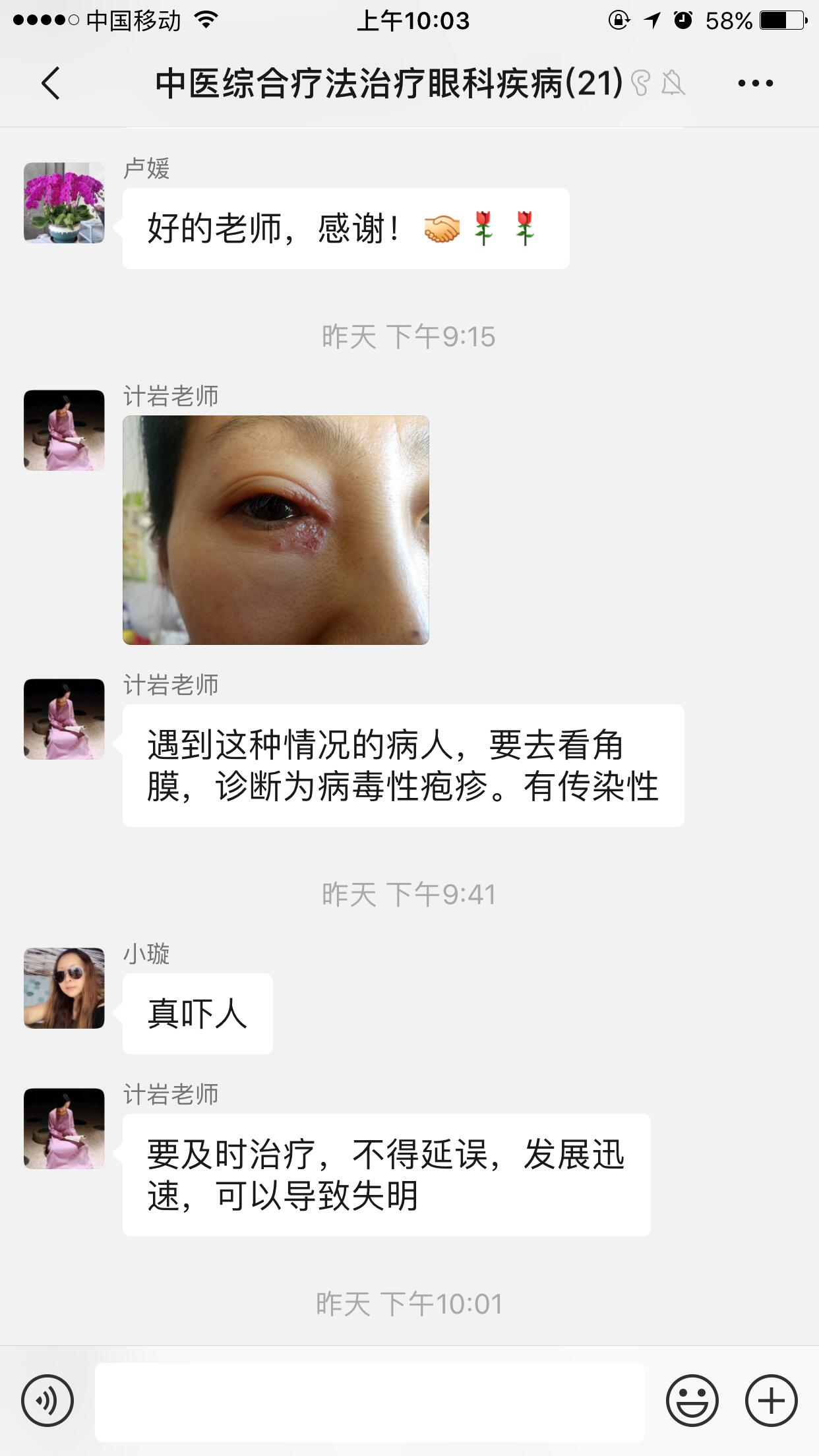 广安纯手法缓解近视眼