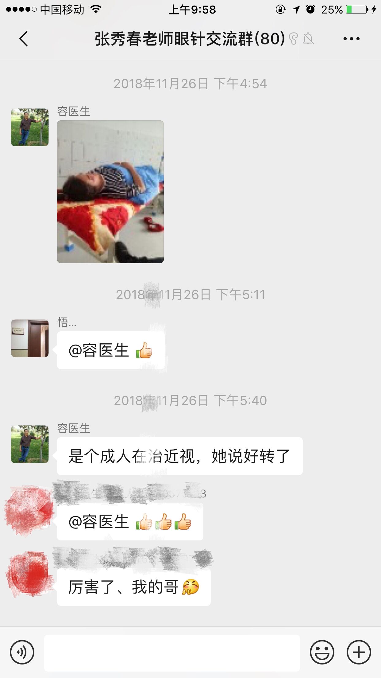 苏州针灸缓解近视眼