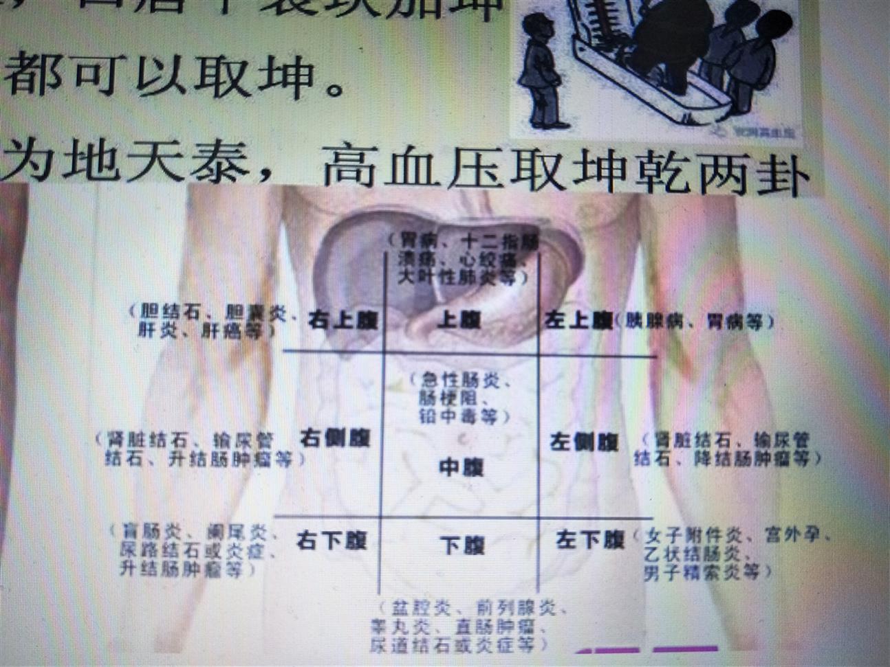 北京类疼痛病