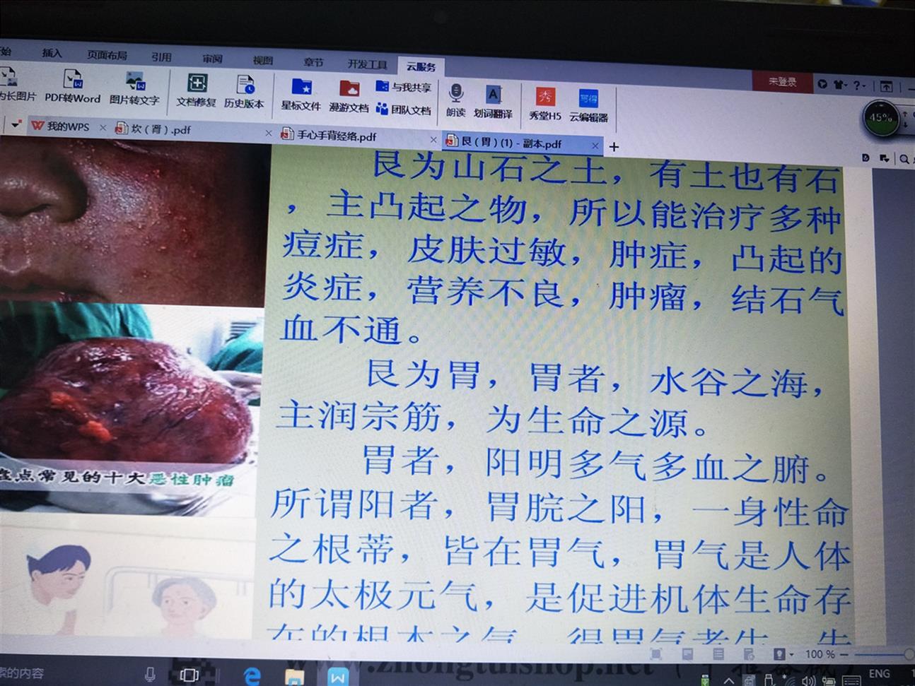 深圳类疼痛病培训时间