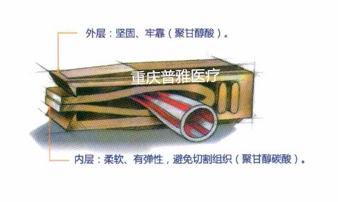 肇庆美敦力可吸收结扎夹费用