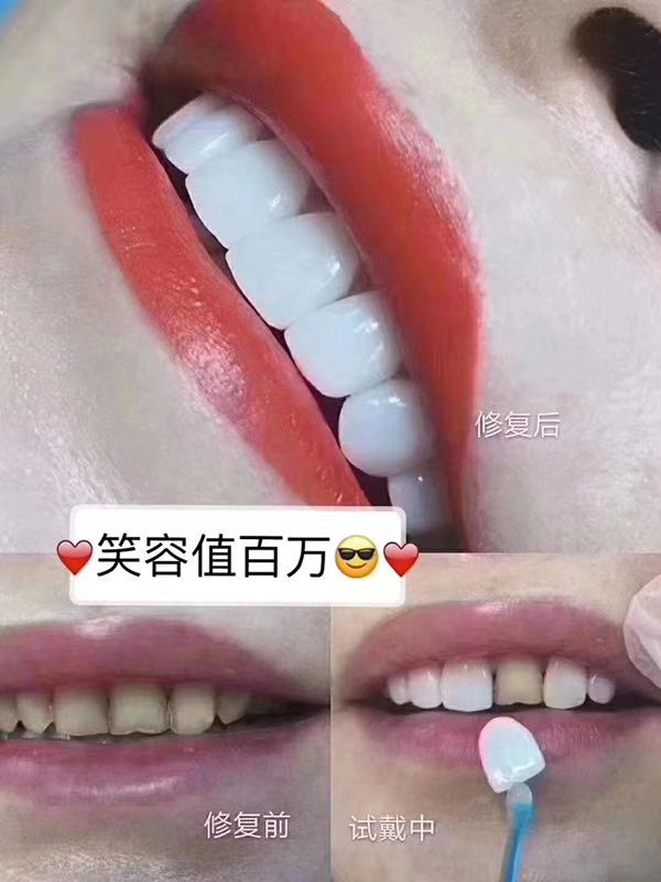 安阳美牙培训 信息推荐 郑州牙美康生物科技供应