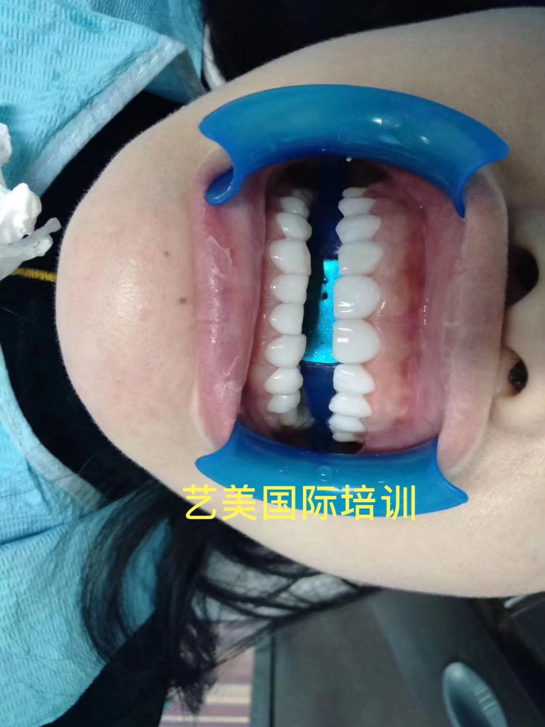 贵州哪里可以学习美牙技术学费多少