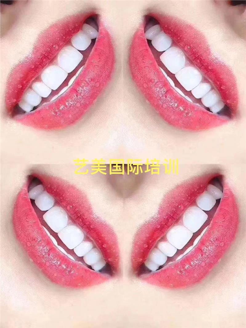 吉安美牙贴面培训机构