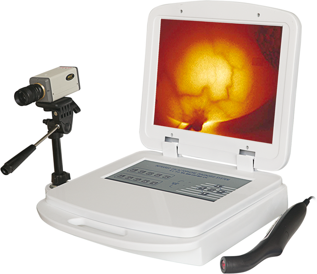 RX-1200B便携式红外乳腺诊断仪