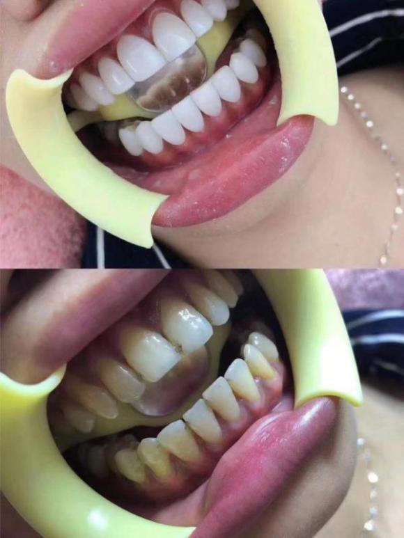 孝感比较正规的牙齿美牙培训