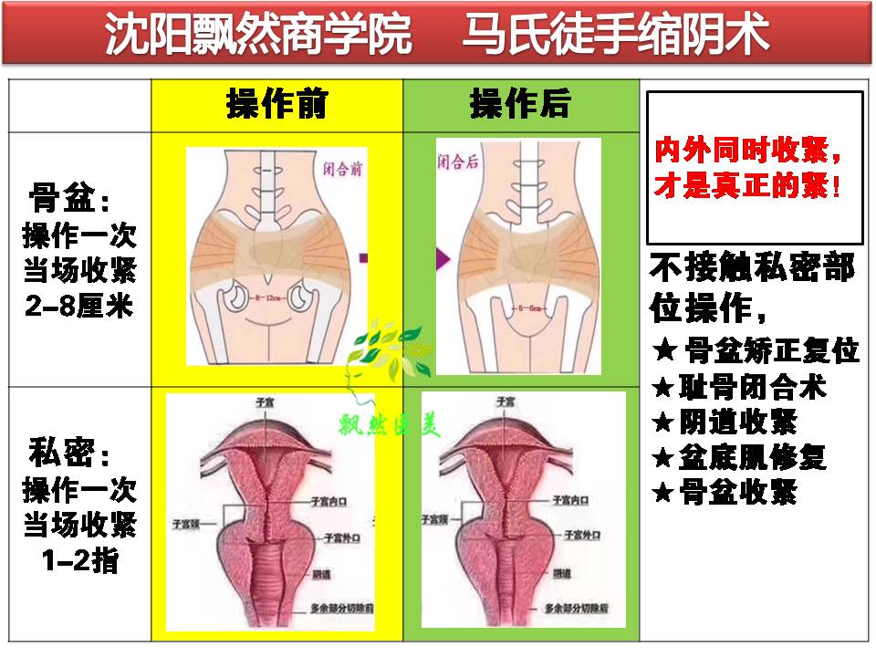 济南正规正骨手法培训学校