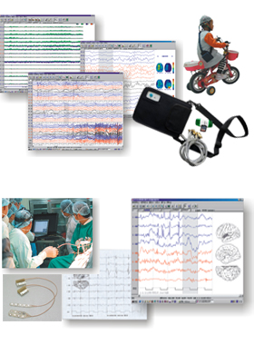 便攜式腦電監護儀ZN7800、ZN7B00型便攜式皮質/床旁腦電監護儀