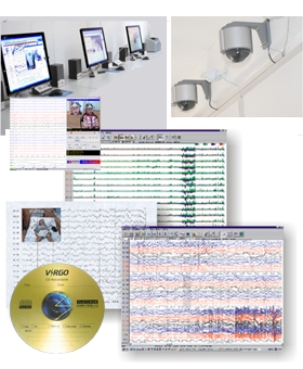 數字化視頻腦電監護儀ZN8000型數字化視頻腦電監護分析系統