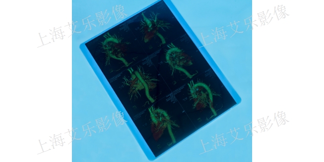 南京医用胶片厂家 服务至上 上海艾乐影像材料供应