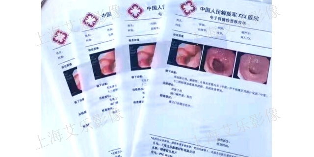 重庆医用打印胶片型号 欢迎咨询 上海艾乐影像材料供应