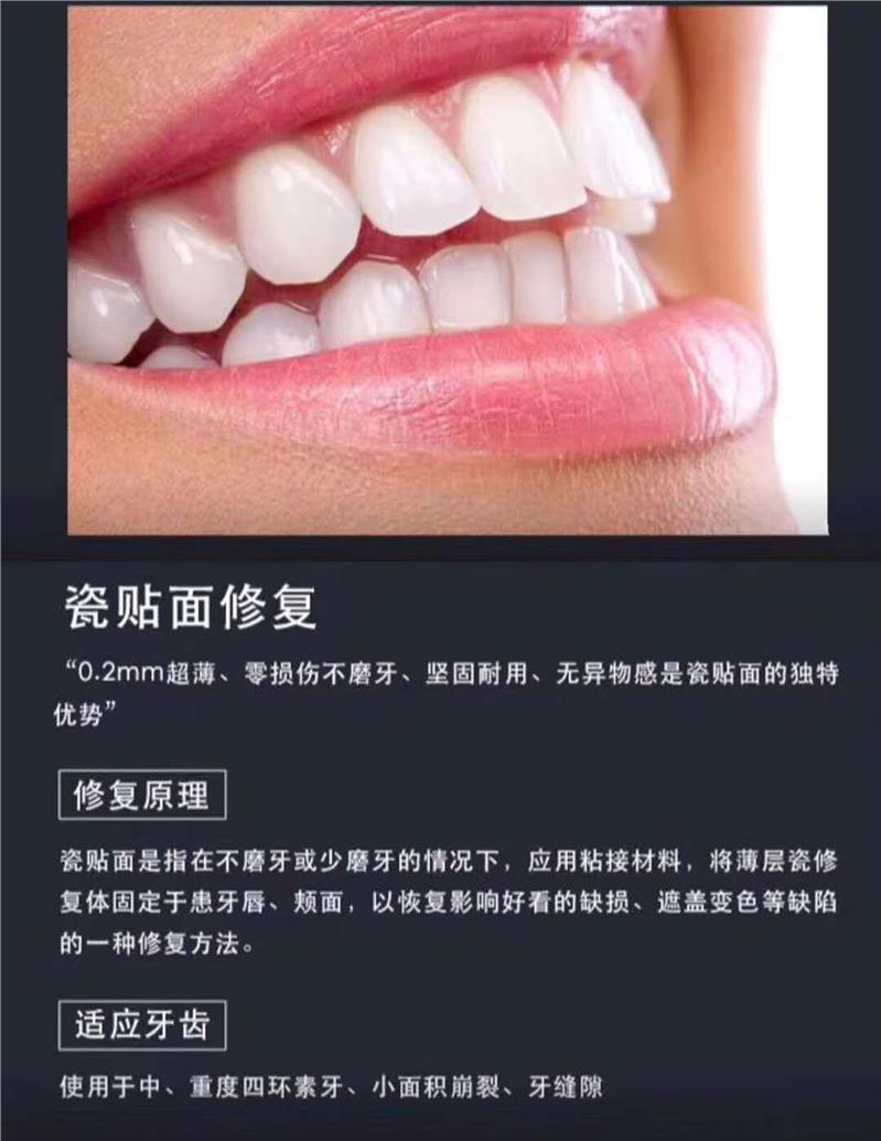 上海美牙技术培训_上海美牙技术培训学校_一对一教学