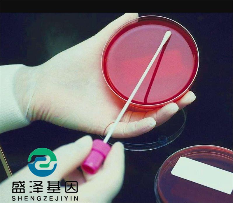 广东中山血型亲子鉴定怎么做