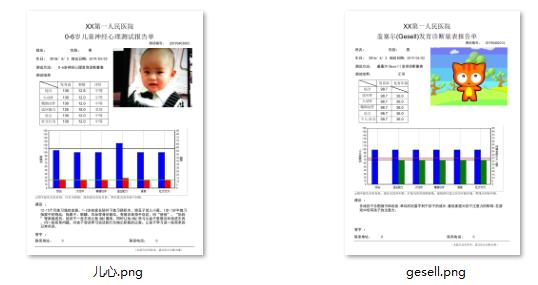 漯河格赛尔发育诊断量表软件和工具包