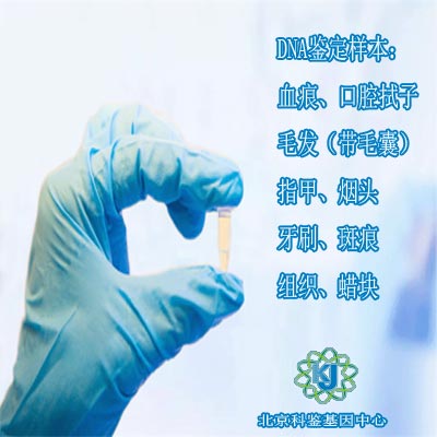 广州荔湾区本地无创亲子鉴定的费用 无创DNA亲子鉴定