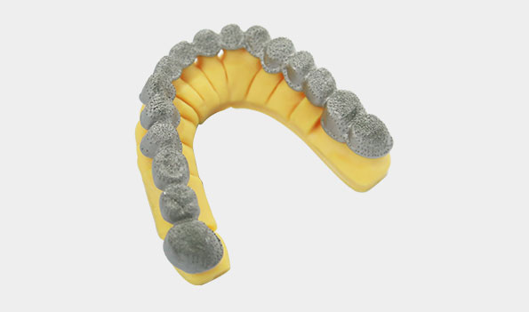3D打印SLM/SLSSLA产品定制牙齿陶瓷内冠
