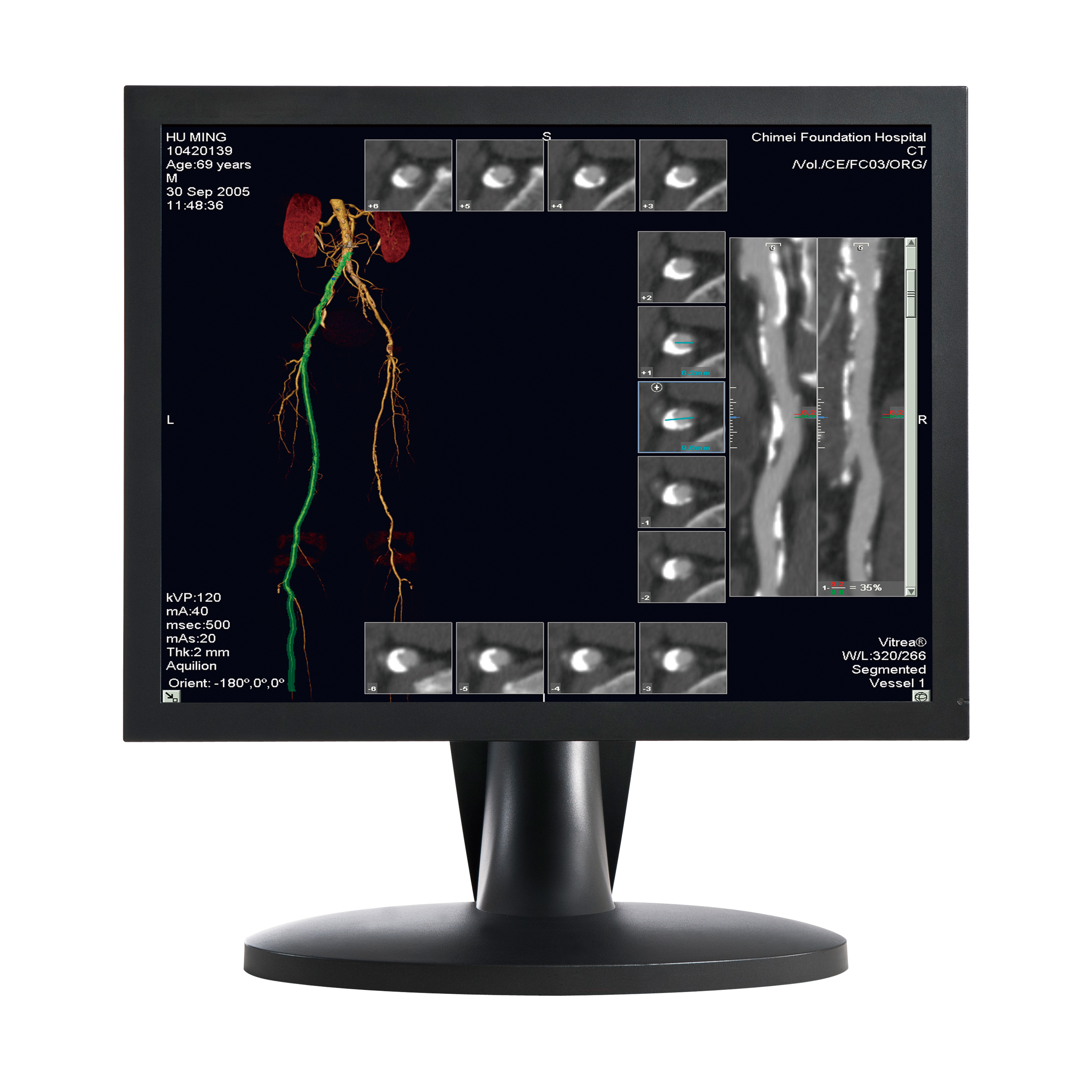 工业探伤X射线数字化成像系统高清灰阶显示器