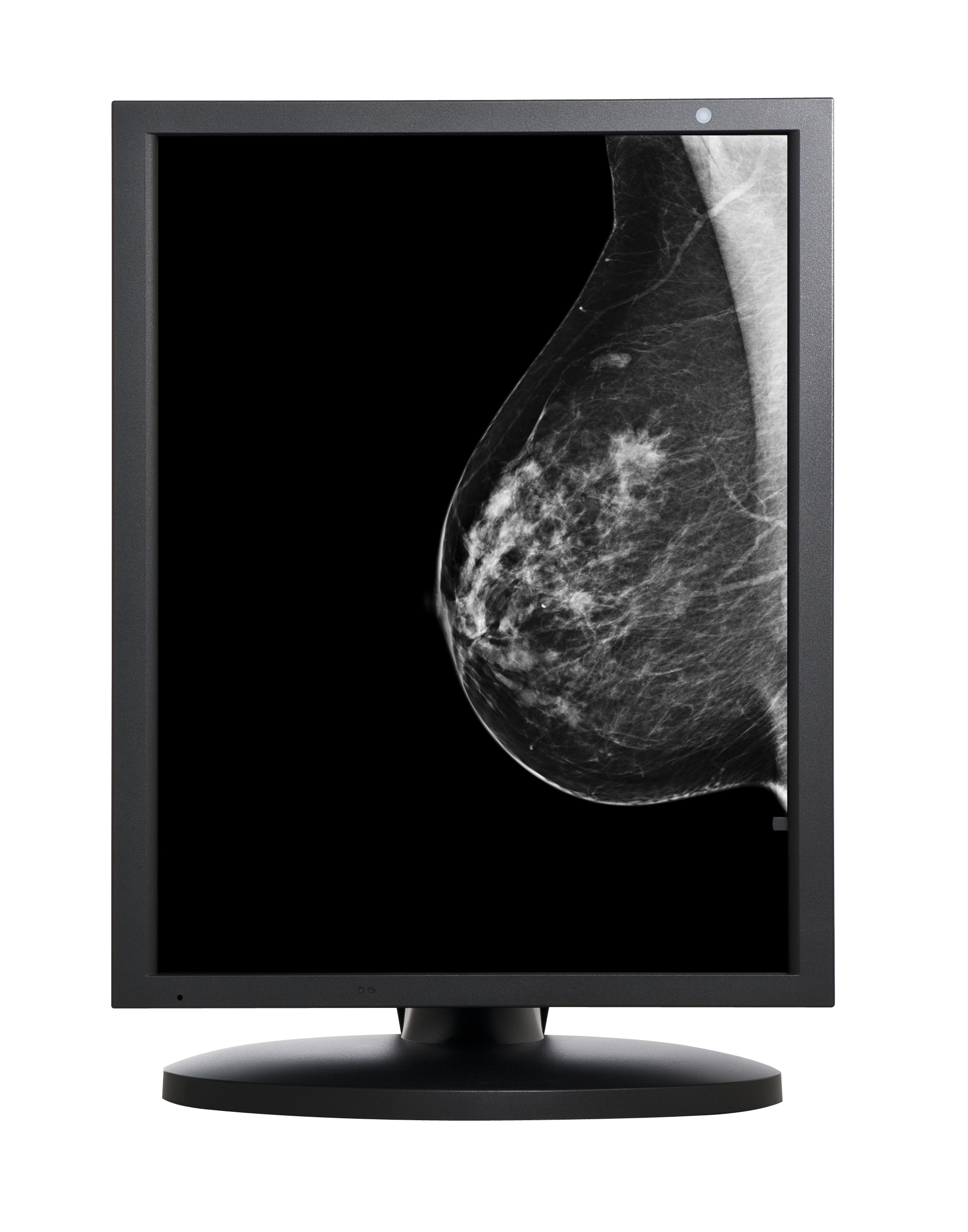 5M灰阶乳腺医用显示器