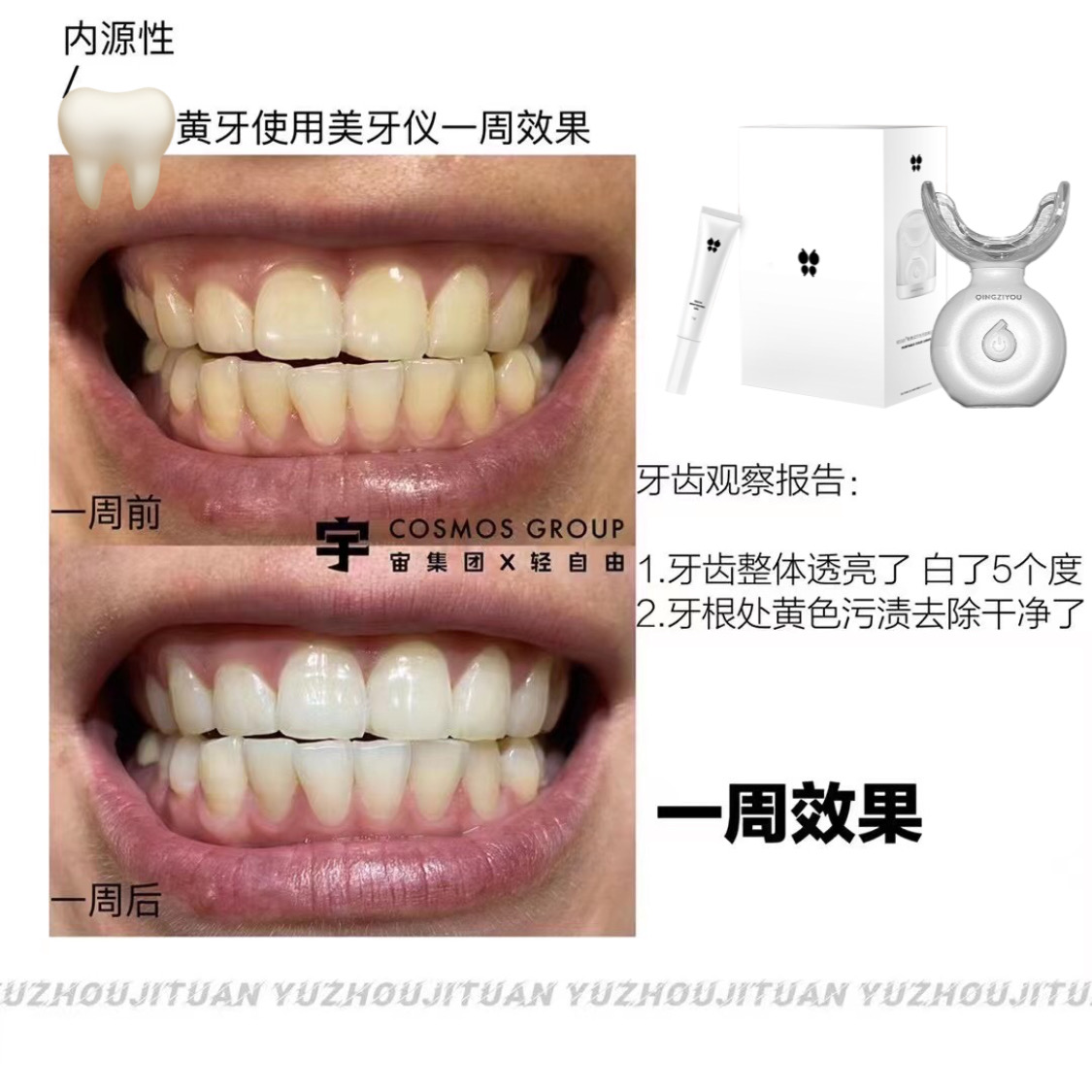碧缇福二代美牙仪全新上市 让你的牙齿更白更透亮