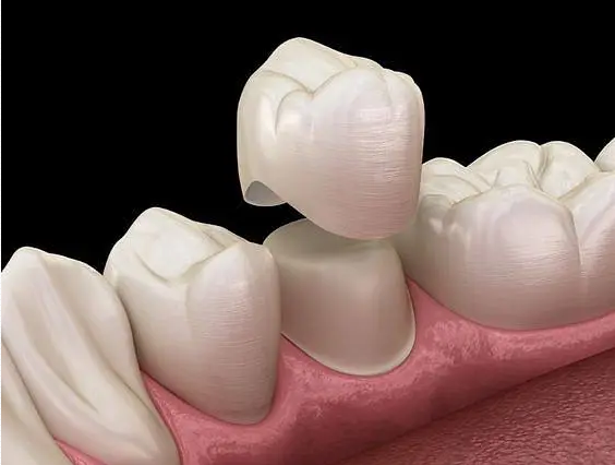 中国假牙义齿出口 国外寻找牙诊所合作 美国 法国 德国