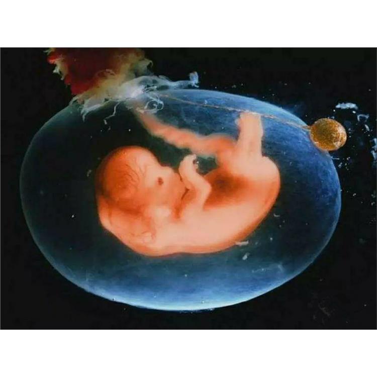产前无创胎儿亲子鉴定_腹中胎儿能不能做亲子鉴定
