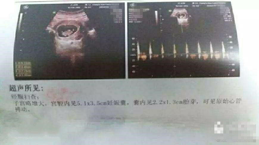 北京无创胎儿亲子鉴定地址