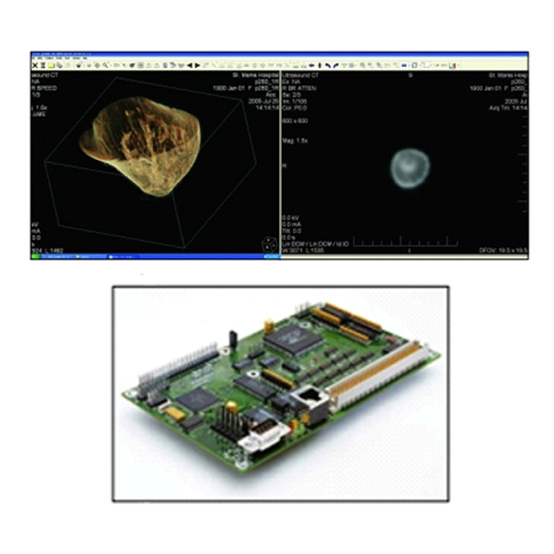TechniScan医疗系统案例—— TechniScan使用Galil控制器促成精确无痛的乳房检查