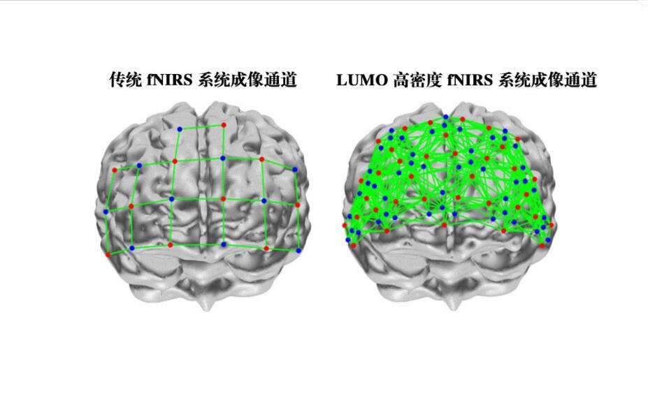 LUMO近红外脑功能**扫描系统