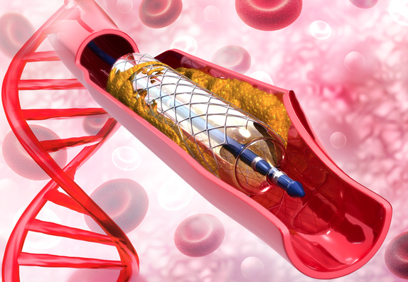 血管支架符合生物相容性涂层