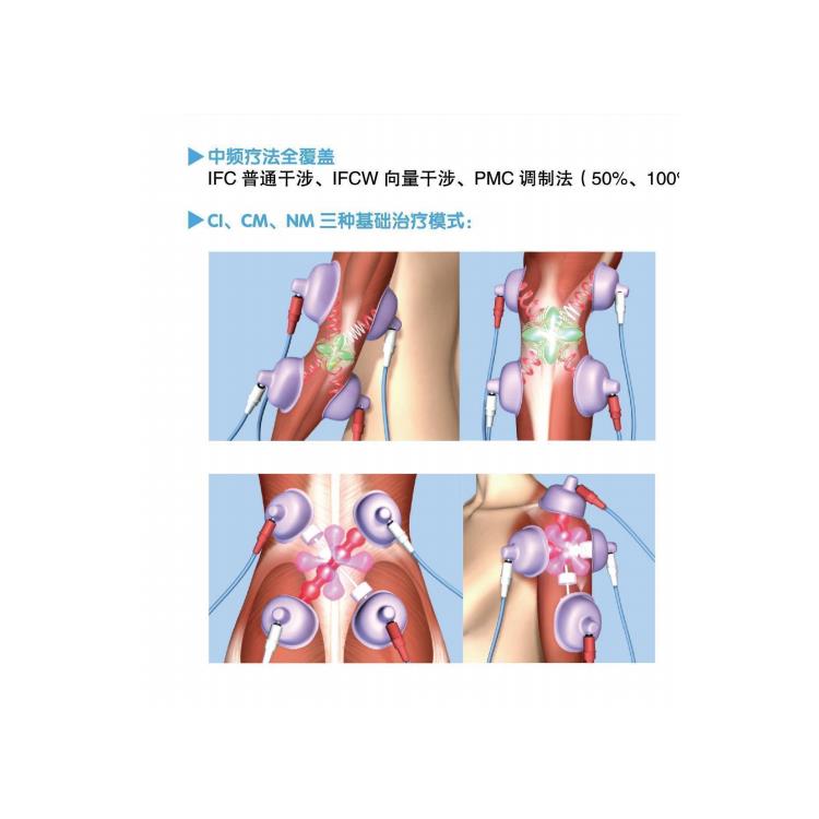 辽源麦笛珂斯中频治疗仪IFC α1