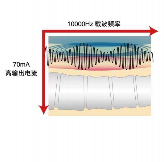 连云港麦笛珂斯中频治疗仪IFC α1