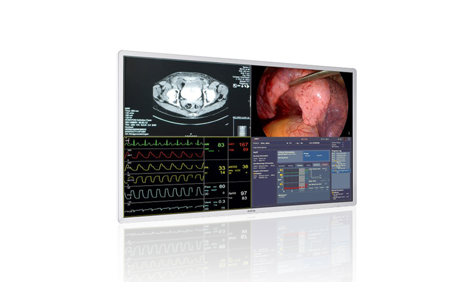 监视器MDSC-8255 4KUHD 大屏幕外科手术显示器