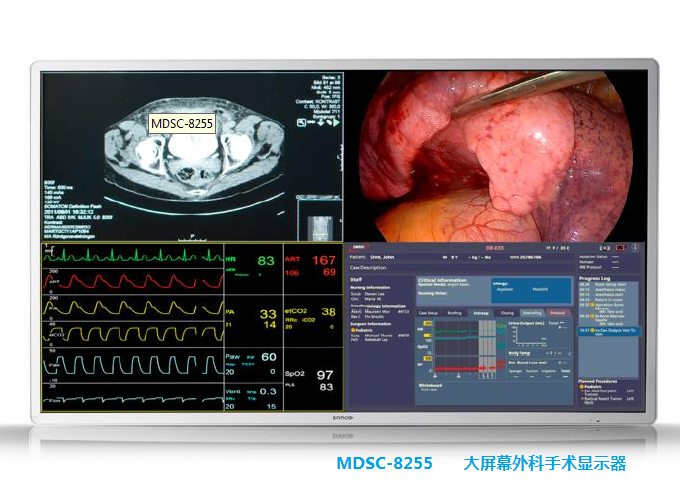 巴可55寸大屏幕4K外科手术监视器MDSC-8255