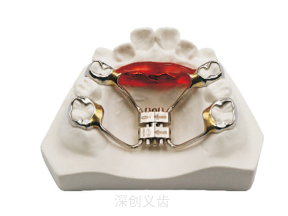 广东下颌磨牙推进器公司 深圳市深创义齿技术供应