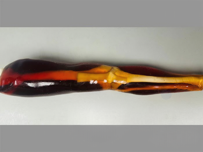 KE-A02成人膝关节模体