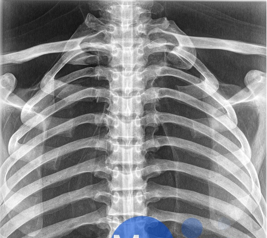 202504141125080625484.png